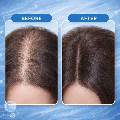 Rootiva™ Rosemary Hair Growth Serum